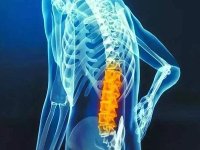 【正骨培训】康道正骨培训专家分析腰突患者不能做哪些运动